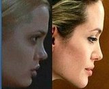 angelina jolie plastic surgeons