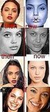 angelina jolie plastic surgeons 