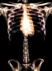 How to Build Stronger Bones