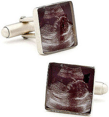 Sonogram Cufflinks: Ga Ga or Gag? Sonogram Cufflinks: Ga Ga or Gag?