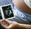 Gender Differences Between Pregnancies