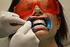 Tooth Whitening: Knowing Is Half the Battle, Say Dentists