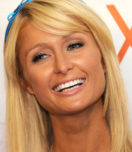 Paris Hilton Teeth
