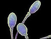 Woman Wins Legal Fight to Harvest Dead Fiance's Sperm