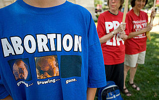 Why Is the Abortion Debate So Extreme in America? 