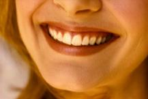Wedding Prep:  Get Your Smile Ready