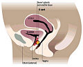 Where is Your G-spot?