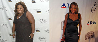 More Than Cosmetic, Gastric Bypass Surgery Saves Lives