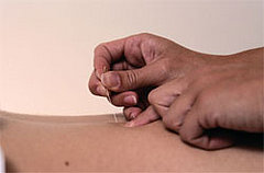 Five Alternative Treatments That Work