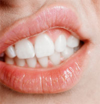 Trick or Treat for Your Teeth