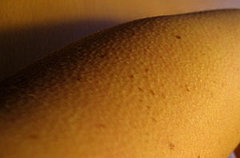 A Quick Explanation of the Physiology of Goosebumps