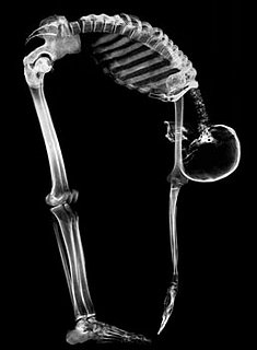 Baby Wellness: Strong Bones