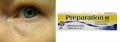 Get The Most From Your Makeup: Puffy Eyes