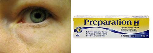Get The Most From Your Makeup: Puffy Eyes
