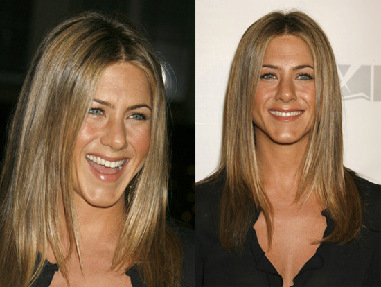 The One Where Jennifer Aniston Fixes Botched Surgery
