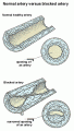 The Good, The Bad and the Healthy: Cholesterol