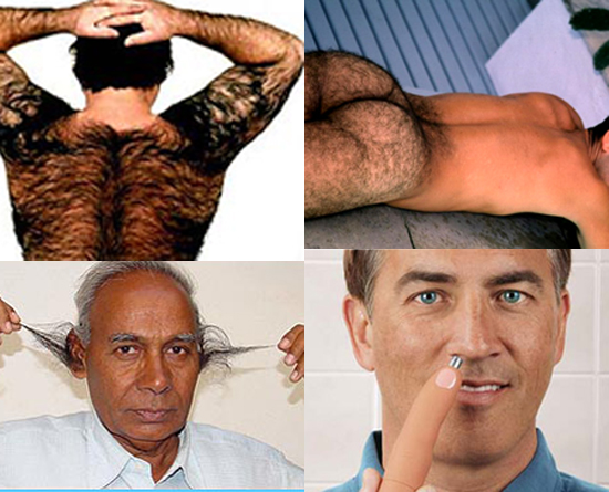 What's Worse: Back, Ass, Ear or Nose Hair?